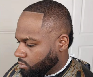 Beard and fade